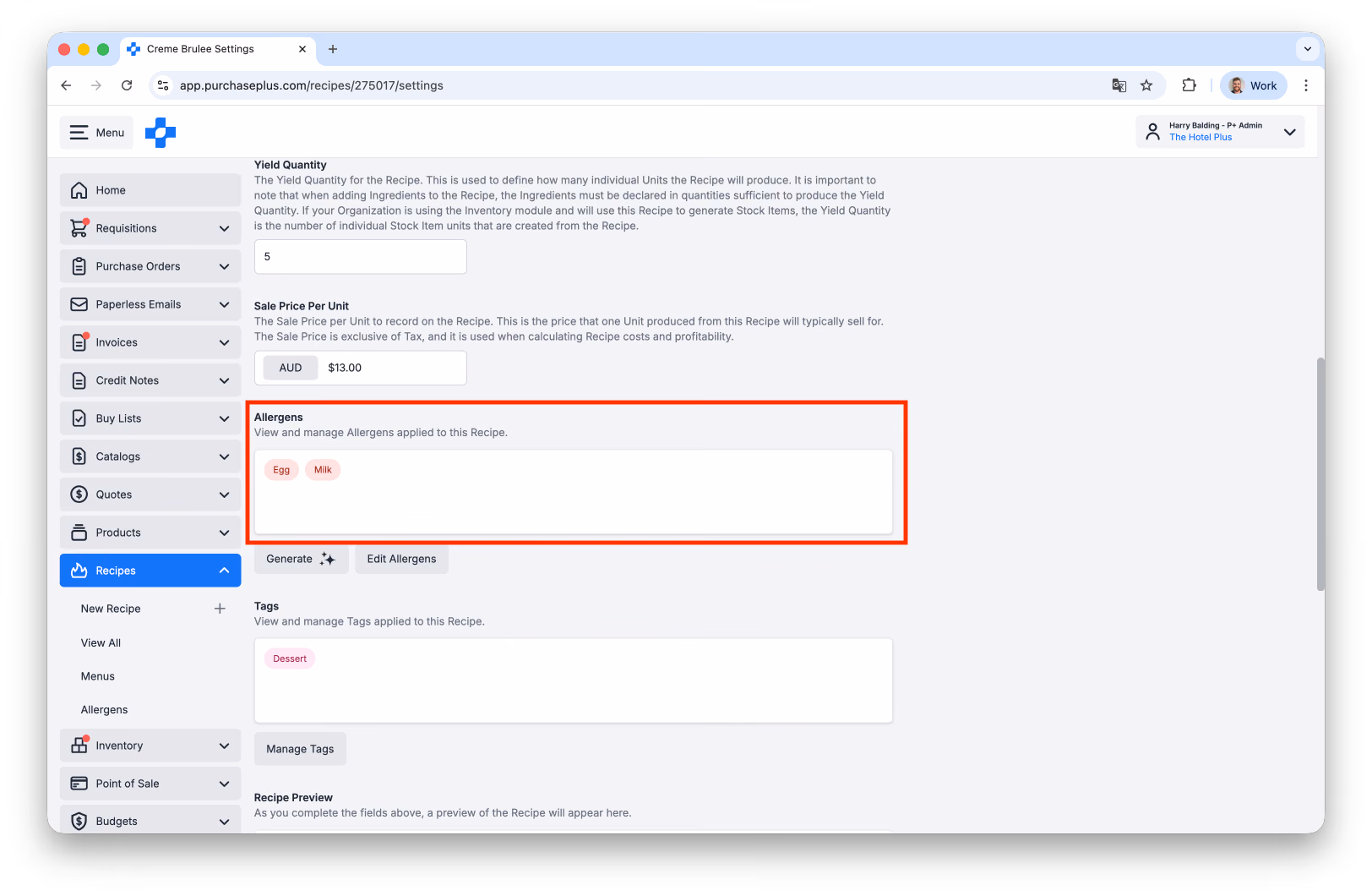 View a Recipes Allergens on Settings tab